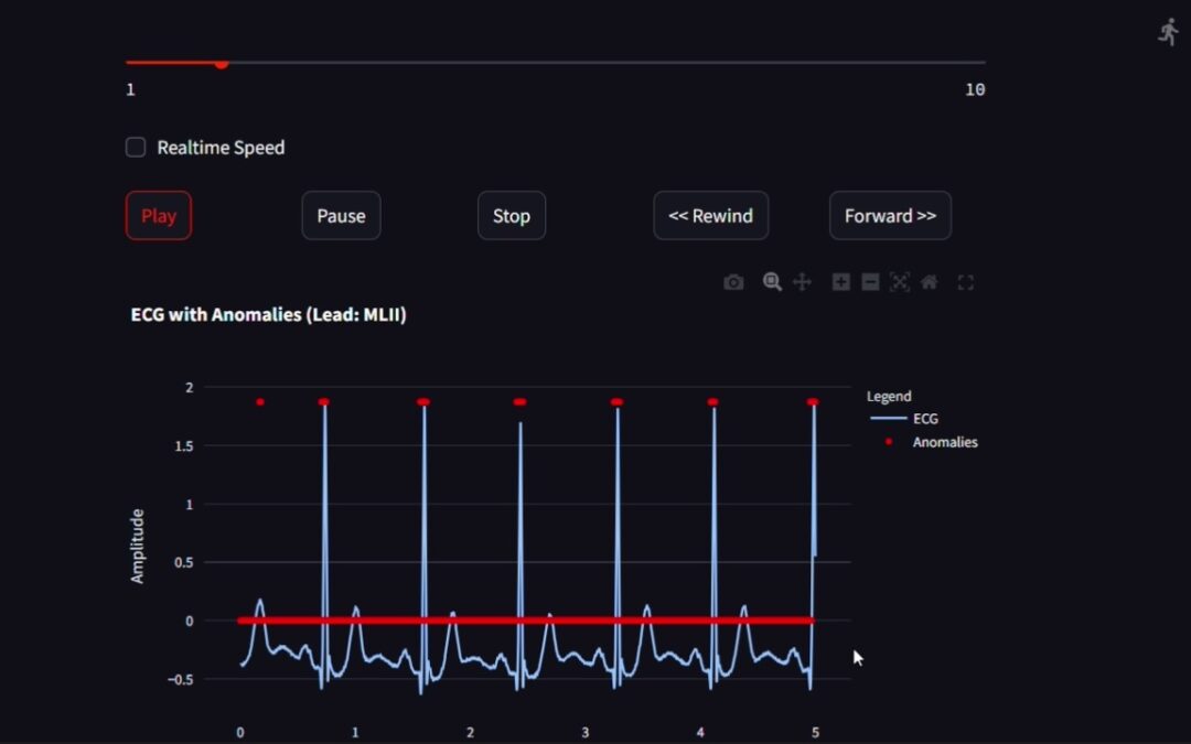 Detecting Heart Anomalies: A Machine Learning Approach Using Isolation Forest for Arrhythmia Classification